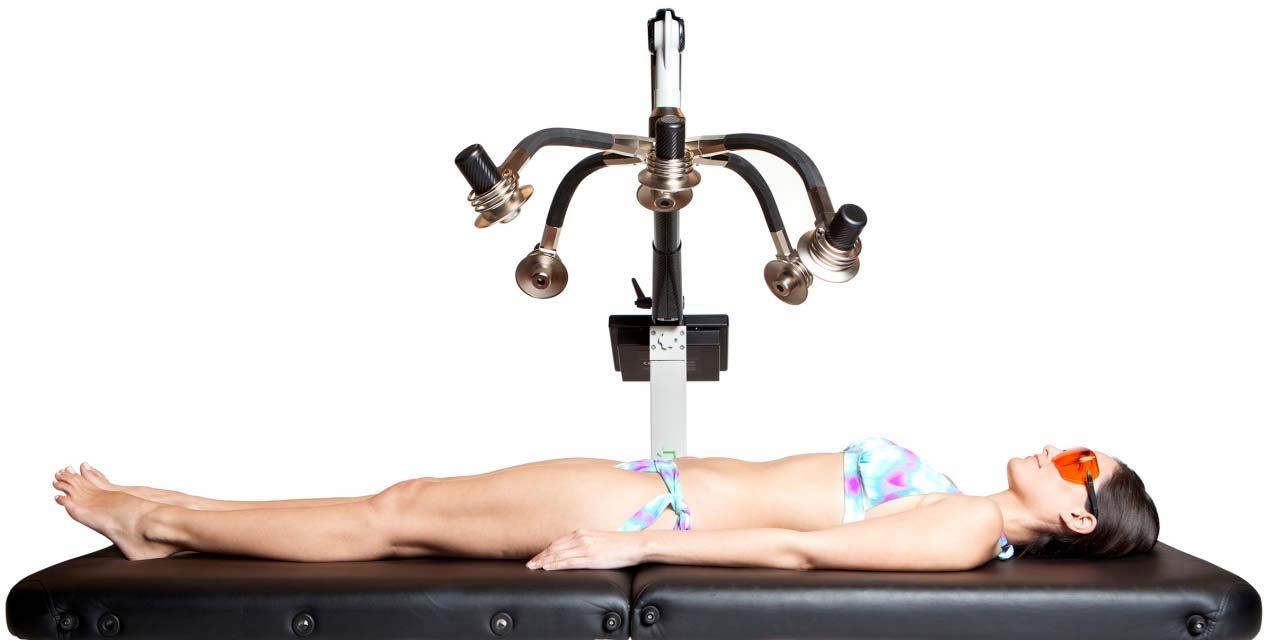 Patient lying under the Zerona Z6 cold-laser arms during a body-contouring session